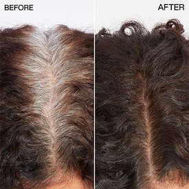 BeforeandAfterCG10Min